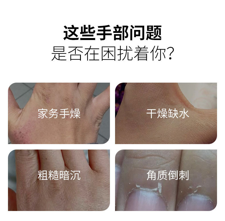護(hù)手霜幫您解決手部以下問題